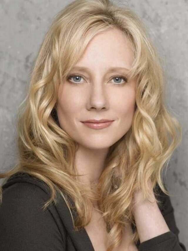 anne heche accident | Anne Heche hospitalized after fiery car crash