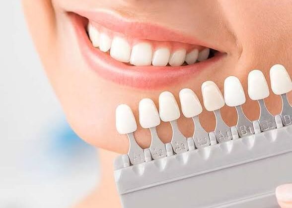 Perfect Smile with a Dentist in San Diego, CA 10 Perfect Smile with a Dentist in San Diego, CA